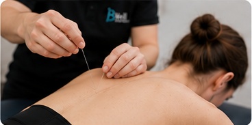 Practitioner performing IMS dry needling treatment on a patient’s upper back.